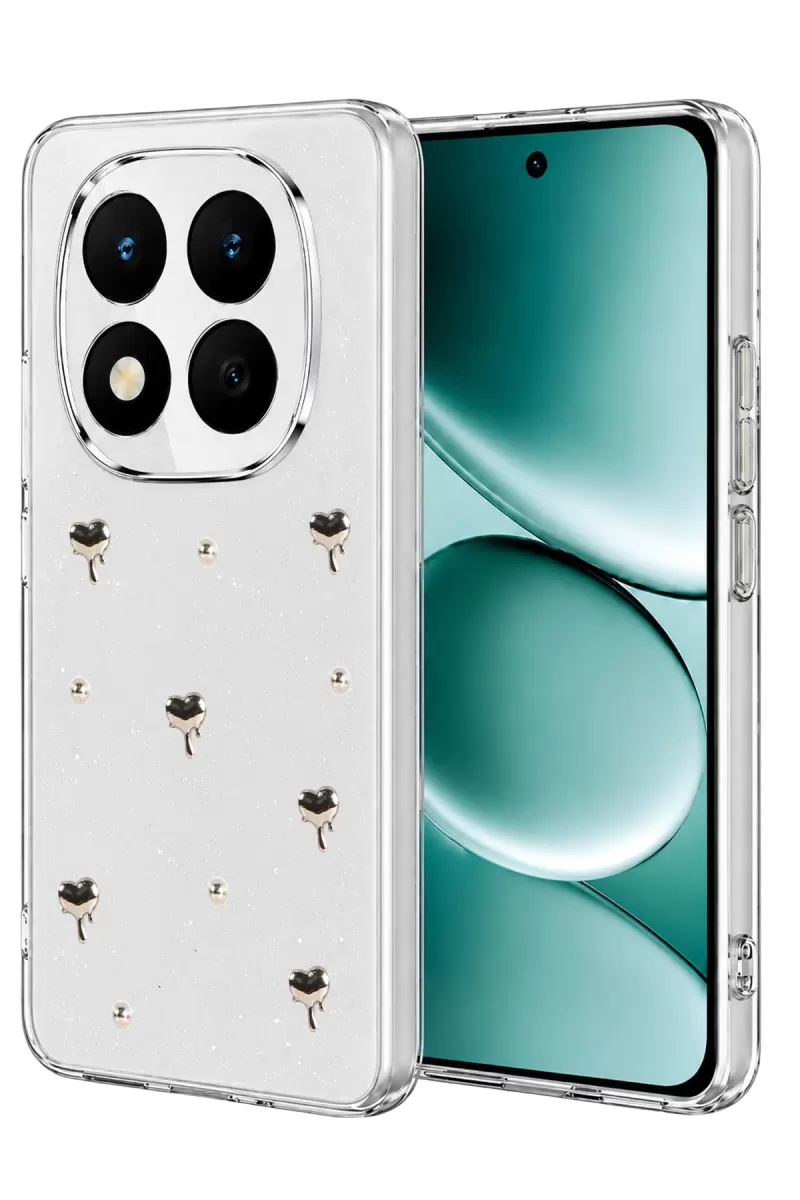 Xiaomi Redmi Note 15 4G Uyumlu Fiyonk Desenli Kapak - Desen 1