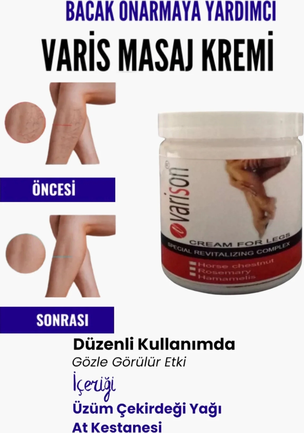 Süper Bölgesi Için Bacak Yardımcı ve Varison Masaj Kremi 200 ml