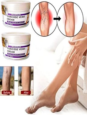 Varicose And Spider Veins Soothing Leg Cream Bacak Bakım Kremi 100 ml x 2 Adet
