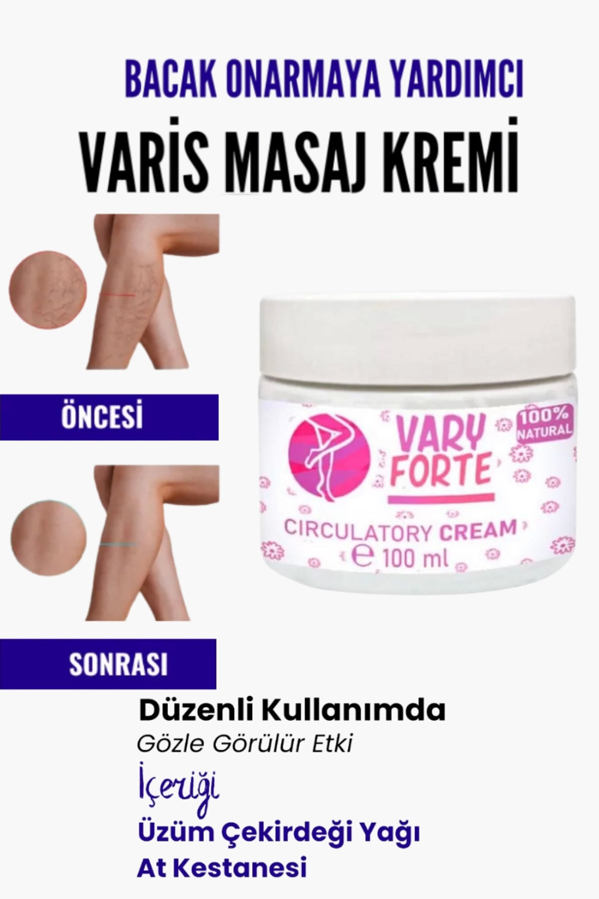 Var.is Bölgesi Için Bacak Onarmaya Yardımcı Ve Besleyici Varyforte Masaj Kremi 100 ml