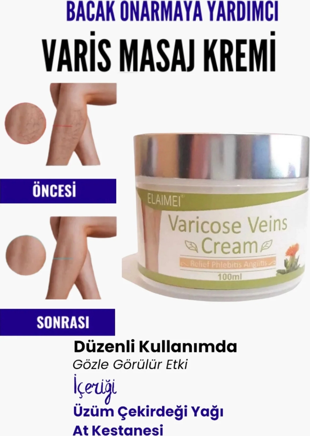 Bölgesi Için Bacak Varicose Masaj Kremi 100 ml